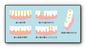 村上信五の歯が茶色く歯並びが汚いと話題に 原因や改善点は Diamondpress